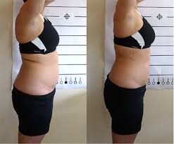 <p>Over <strong>20,000 women</strong> have already discovered how easy it is to <strong>reshape their waist in 20 minutes a day</strong></p>