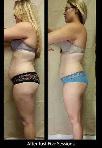 <p>Over <strong>20,000 women</strong> have already discovered how easy it is to <strong>reshape their waist in 20 minutes a day</strong></p>