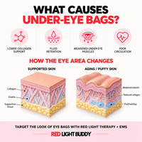 Diagram of what causes under-eye bags and how the skin under the eye changes with age
