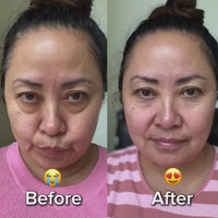 Before and after video of a customer using the Eye Snatcher Buddy